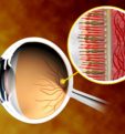 Будущее медицины: лечение заболеваний глаз стволовыми клетками